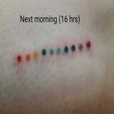 How to Conduct a Patch Test for Tattoos: The Art of a Dot Tattoo & Waiting