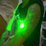 The Interaction Between Tattoo Ink Pigments and Laser Wavelengths in Tattoo Removal